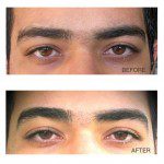Eyebrow threading result on client with thick brows in Nashville