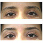 clean shape and natural arch by Ferie in Nashville